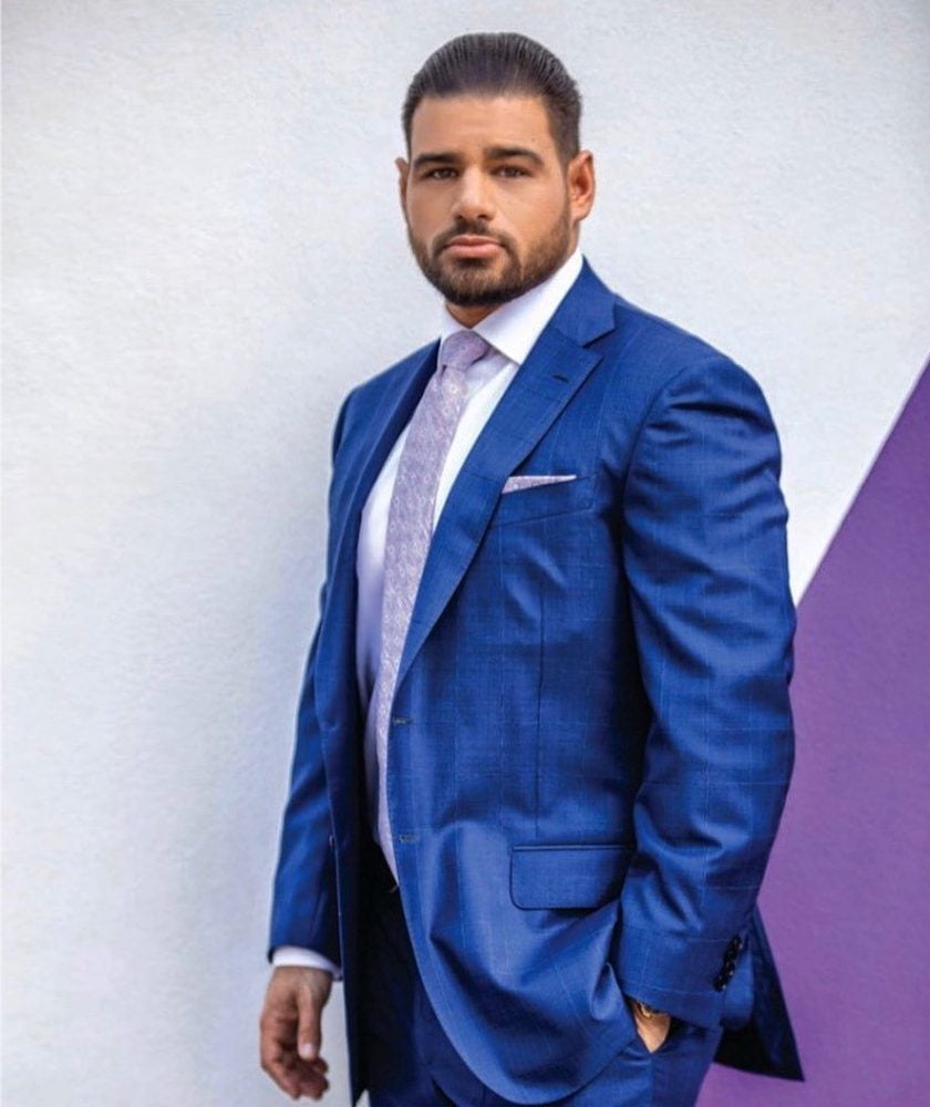 miami-hair-transplant